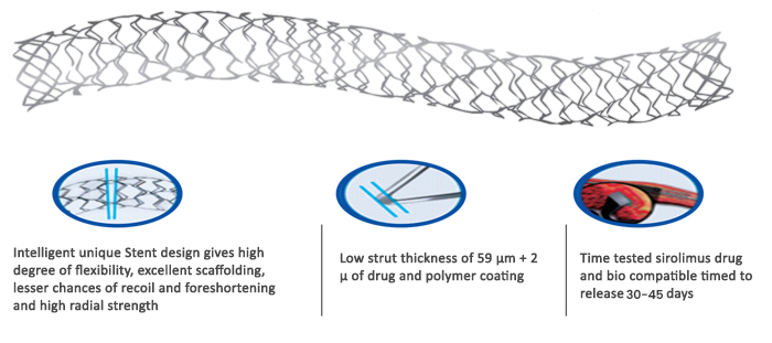 stent-2